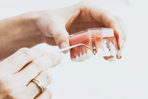 Dentist demonstrating All-on-X prosthesis model with dental implants.