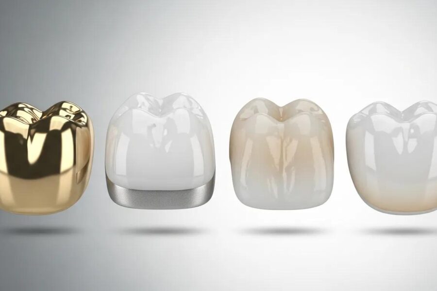 Dental crown materials comparison: gold, porcelain fused to metal (PFM), zirconia, and all-ceramic crowns, showcasing variations in color and structure.
