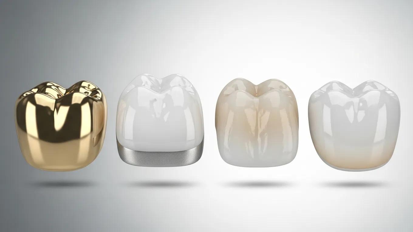 A Guide to Dental Crown Cost and Materials — Why Turkey Is a Global Choice for Treatment
