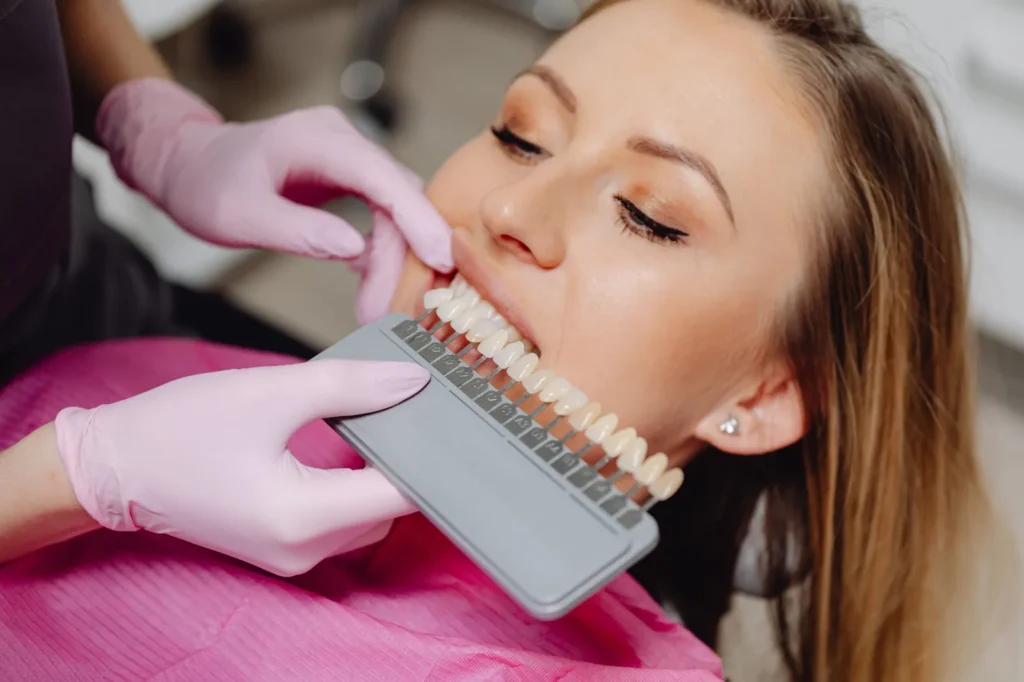 Dentist holding a veneer shade guide against a patient’s teeth to match the colour of her new veneers.