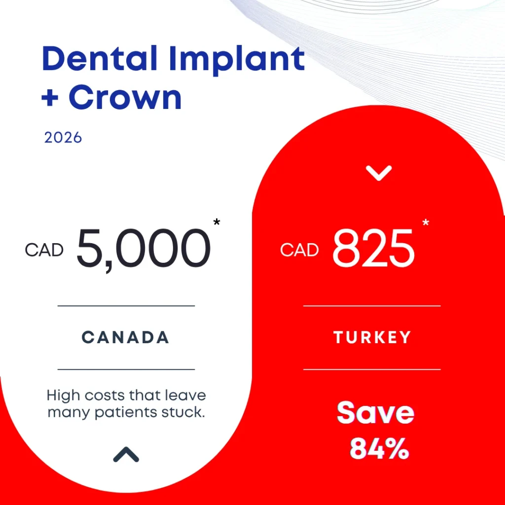 Dental implant and crown cost 2026: CAD 5,000 in Canada vs CAD 825 in Turkey, save 84%